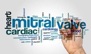 Le traitement percutané de l’insuffisance mitrale