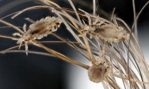 Pédiculose : quoi de neuf ?