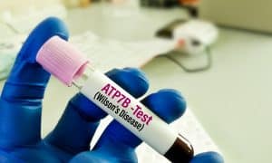 Traitement de la maladie de Wilson chez l’enfant