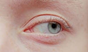 Quoi de neuf dans les pathologies cornéennes ?